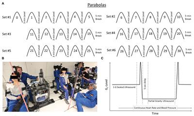 Venous and Arterial Responses to Partial Gravity